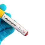diphtheria-near-me: Gloved hand holding a test tube showing a positive result for C. diphtheriae bacteria.