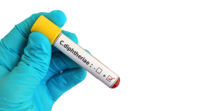diphtheria-near-me: Gloved hand holding a test tube showing a positive result for C. diphtheriae bacteria.